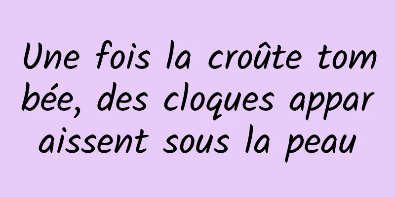 Une fois la croûte tombée, des cloques apparaissent sous la peau