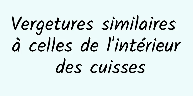 Vergetures similaires à celles de l'intérieur des cuisses