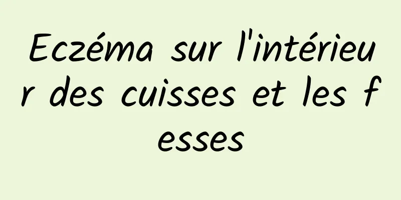 Eczéma sur l'intérieur des cuisses et les fesses