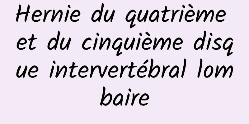 Hernie du quatrième et du cinquième disque intervertébral lombaire