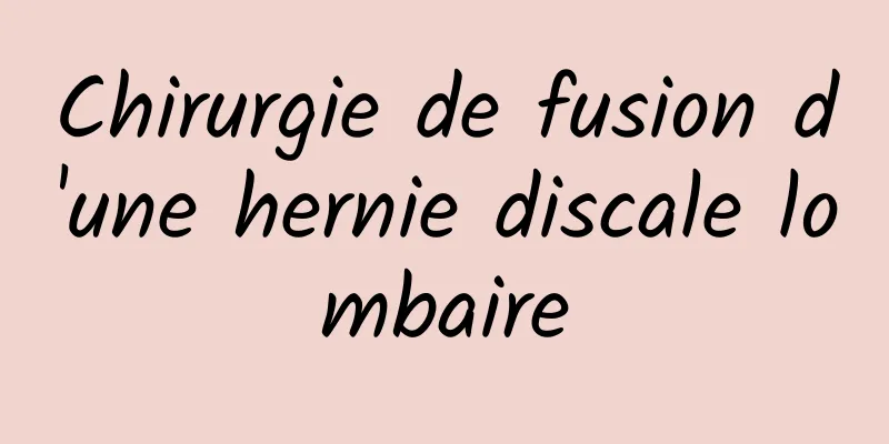 Chirurgie de fusion d'une hernie discale lombaire