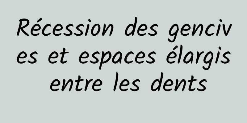 Récession des gencives et espaces élargis entre les dents