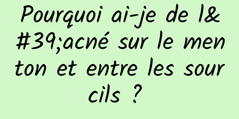 Pourquoi ai-je de l'acné sur le menton et entre les sourcils ? 