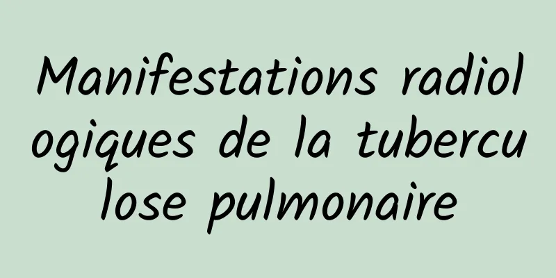 Manifestations radiologiques de la tuberculose pulmonaire