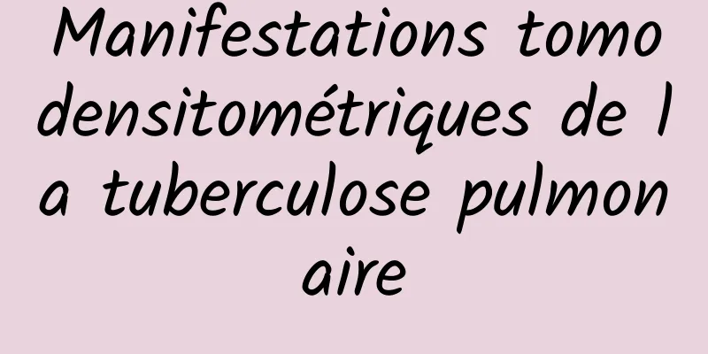 Manifestations tomodensitométriques de la tuberculose pulmonaire