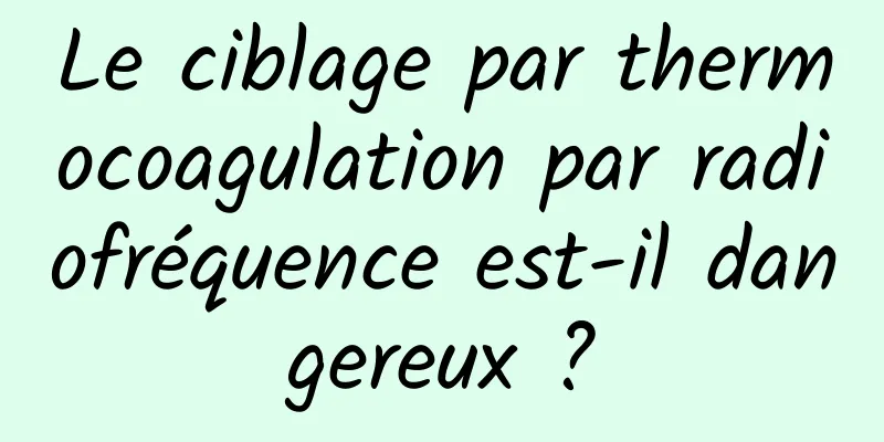 Le ciblage par thermocoagulation par radiofréquence est-il dangereux ?