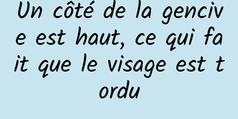 Un côté de la gencive est haut, ce qui fait que le visage est tordu