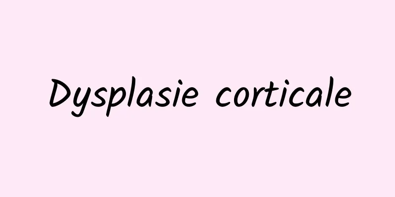 Dysplasie corticale