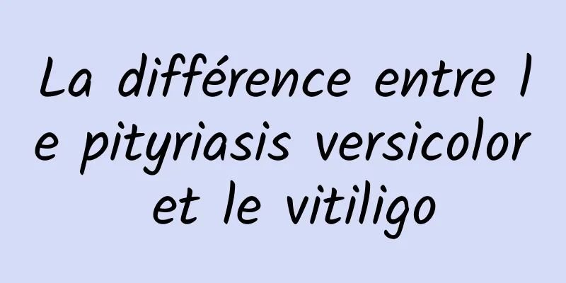 La différence entre le pityriasis versicolor et le vitiligo