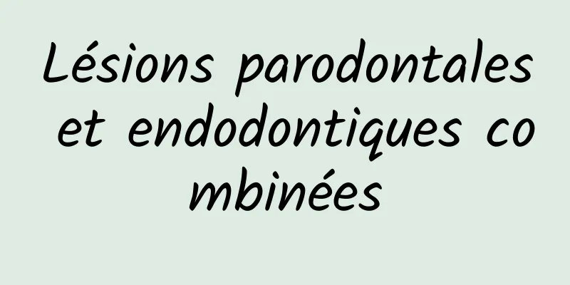 Lésions parodontales et endodontiques combinées