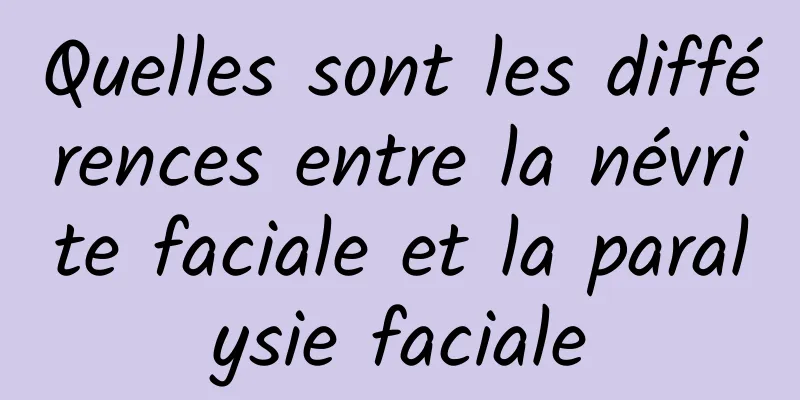 Quelles sont les différences entre la névrite faciale et la paralysie faciale