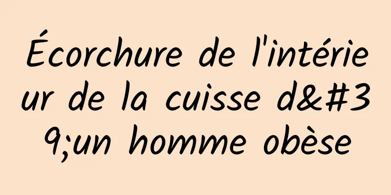 Écorchure de l'intérieur de la cuisse d'un homme obèse