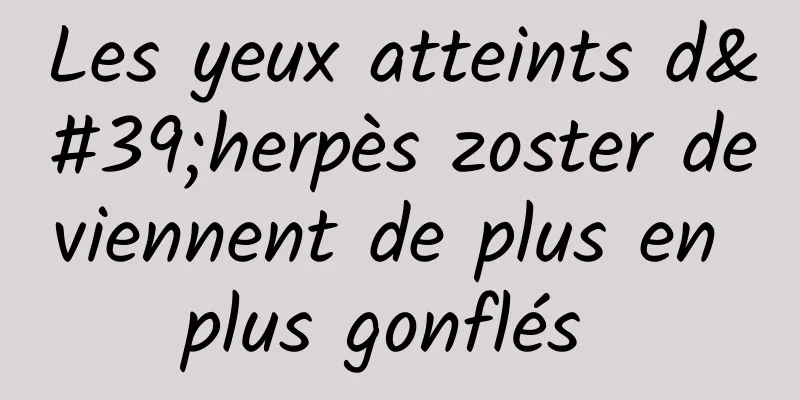 Les yeux atteints d'herpès zoster deviennent de plus en plus gonflés 