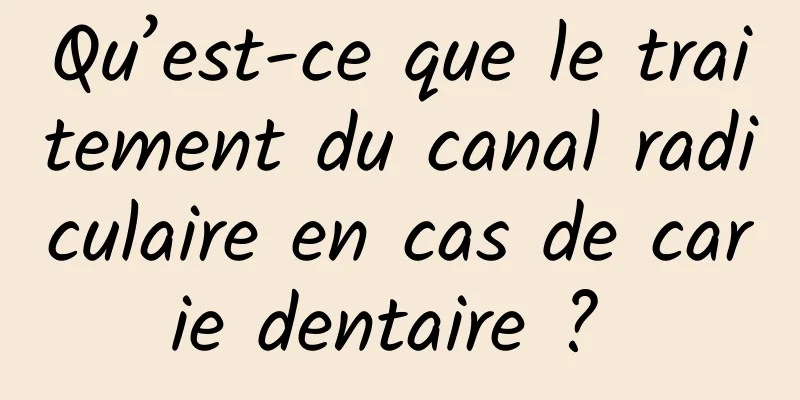 Qu’est-ce que le traitement du canal radiculaire en cas de carie dentaire ? 