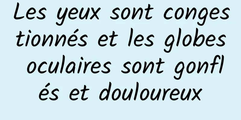 Les yeux sont congestionnés et les globes oculaires sont gonflés et douloureux