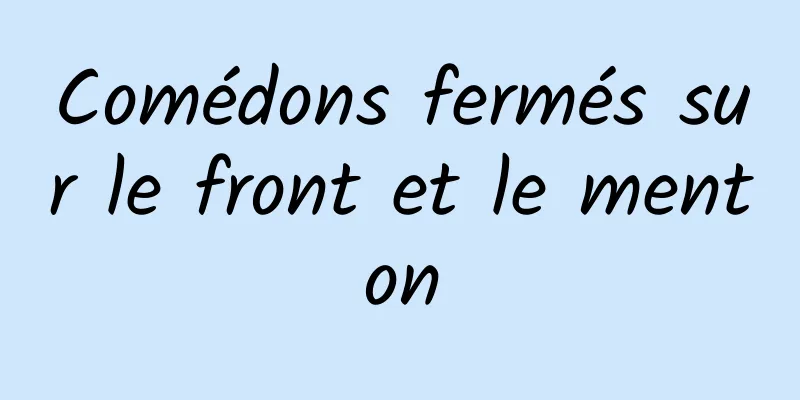 Comédons fermés sur le front et le menton