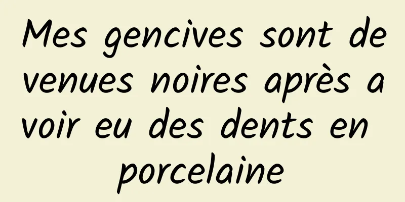 Mes gencives sont devenues noires après avoir eu des dents en porcelaine