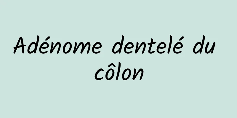 Adénome dentelé du côlon