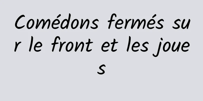 Comédons fermés sur le front et les joues