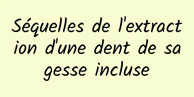 Séquelles de l'extraction d'une dent de sagesse incluse