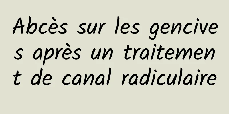 Abcès sur les gencives après un traitement de canal radiculaire