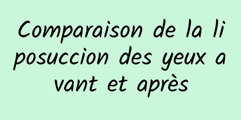 Comparaison de la liposuccion des yeux avant et après