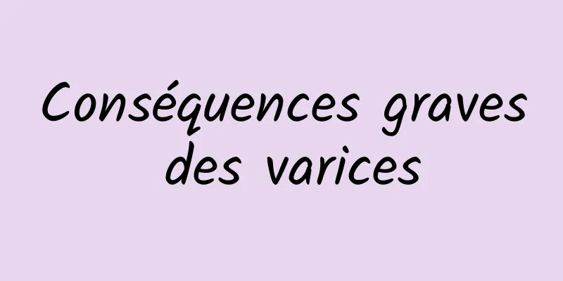 Conséquences graves des varices