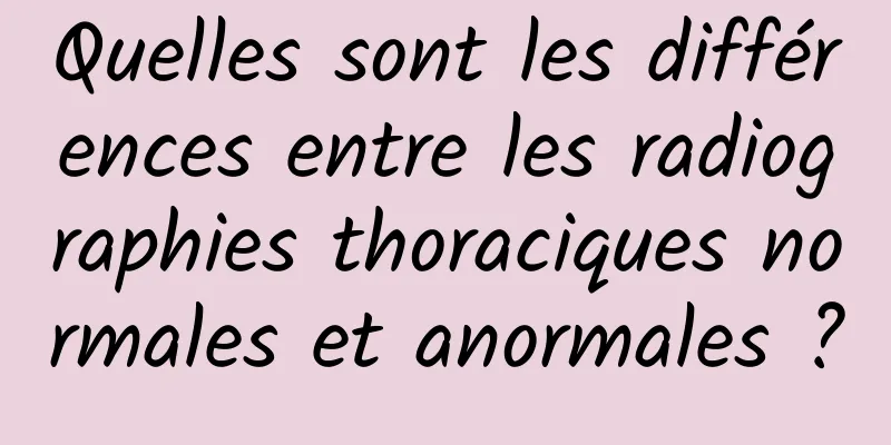 Quelles sont les différences entre les radiographies thoraciques normales et anormales ?