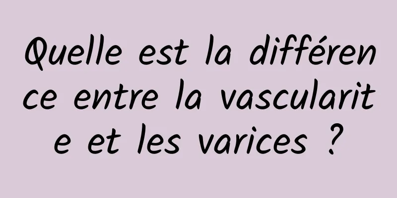 Quelle est la différence entre la vascularite et les varices ?