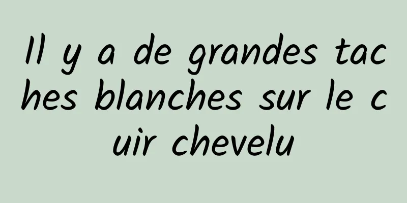 Il y a de grandes taches blanches sur le cuir chevelu