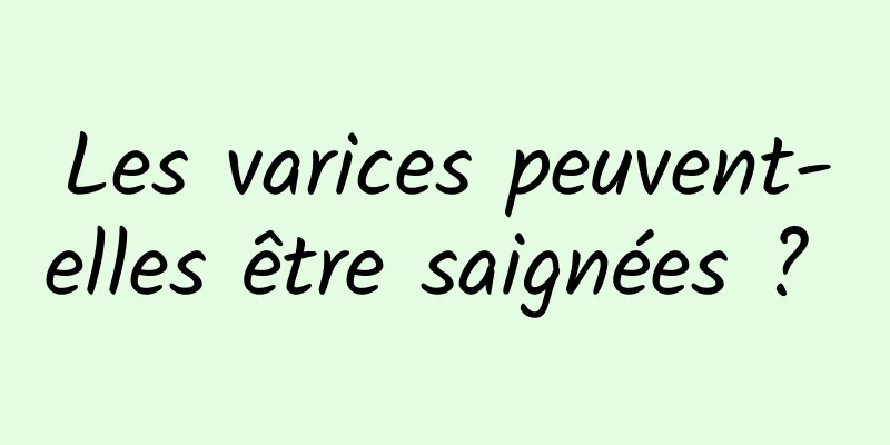 Les varices peuvent-elles être saignées ? 