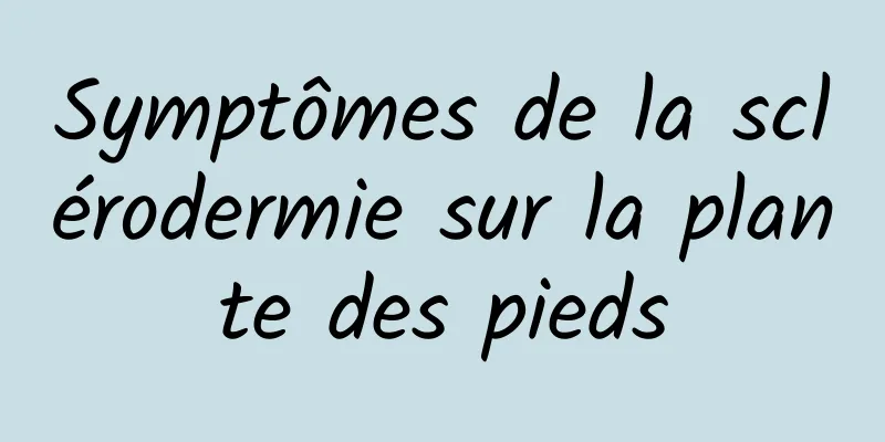 Symptômes de la sclérodermie sur la plante des pieds