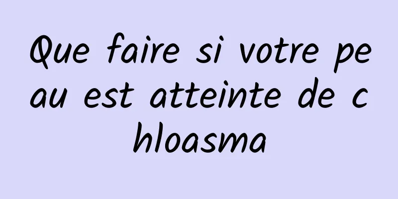 Que faire si votre peau est atteinte de chloasma