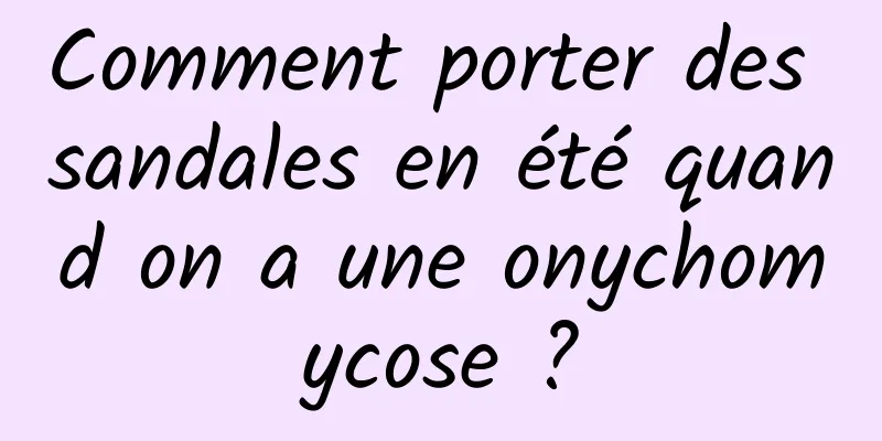 Comment porter des sandales en été quand on a une onychomycose ?