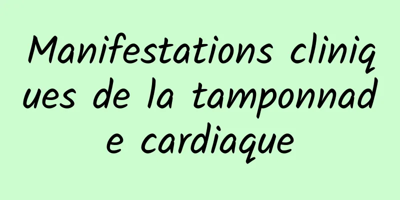 Manifestations cliniques de la tamponnade cardiaque