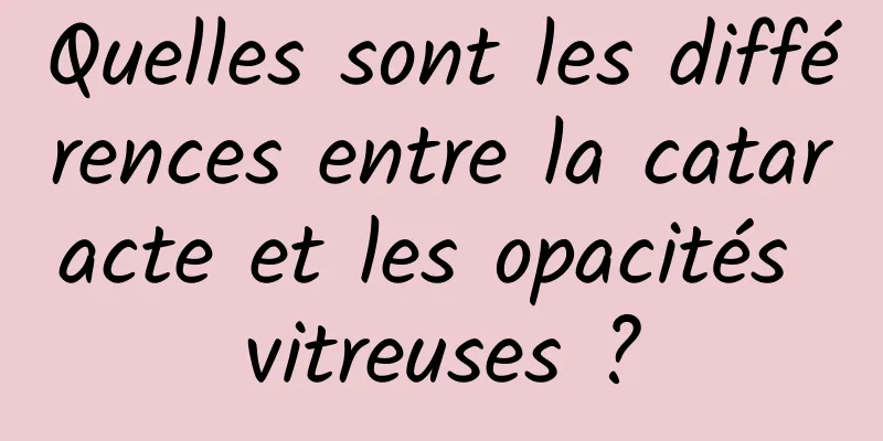 Quelles sont les différences entre la cataracte et les opacités vitreuses ?