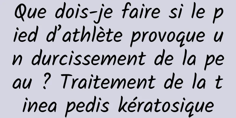 Que dois-je faire si le pied d’athlète provoque un durcissement de la peau ? Traitement de la tinea pedis kératosique