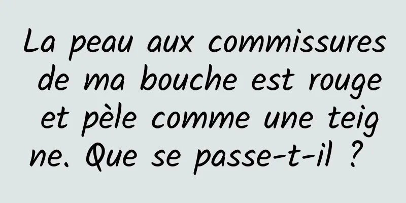 La peau aux commissures de ma bouche est rouge et pèle comme une teigne. Que se passe-t-il ? 