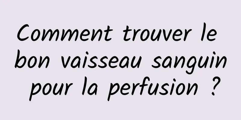 Comment trouver le bon vaisseau sanguin pour la perfusion ?