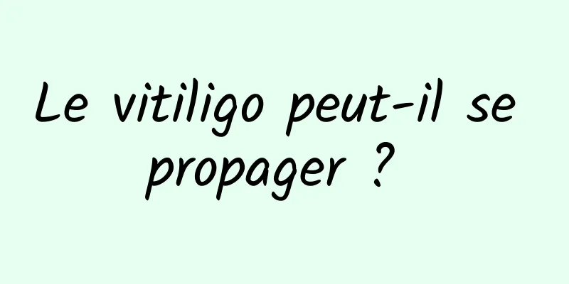 Le vitiligo peut-il se propager ? 