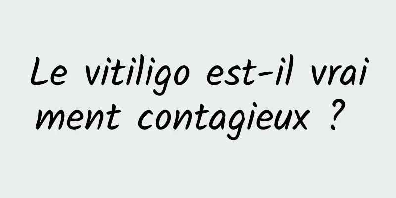 Le vitiligo est-il vraiment contagieux ? 