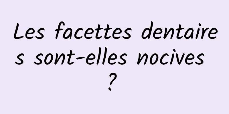 Les facettes dentaires sont-elles nocives ? 