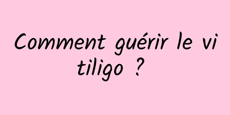 Comment guérir le vitiligo ? 