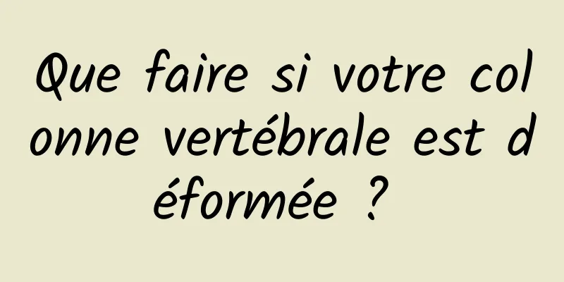 Que faire si votre colonne vertébrale est déformée ? 