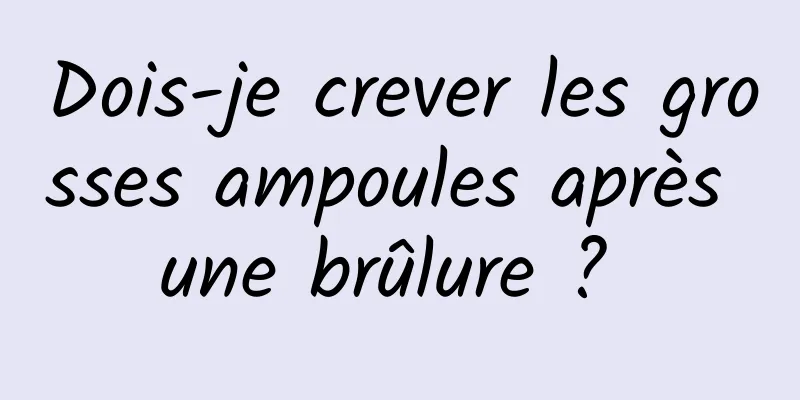 Dois-je crever les grosses ampoules après une brûlure ? 