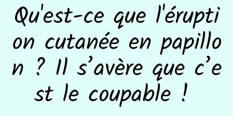 Qu'est-ce que l'éruption cutanée en papillon ? Il s’avère que c’est le coupable ! 