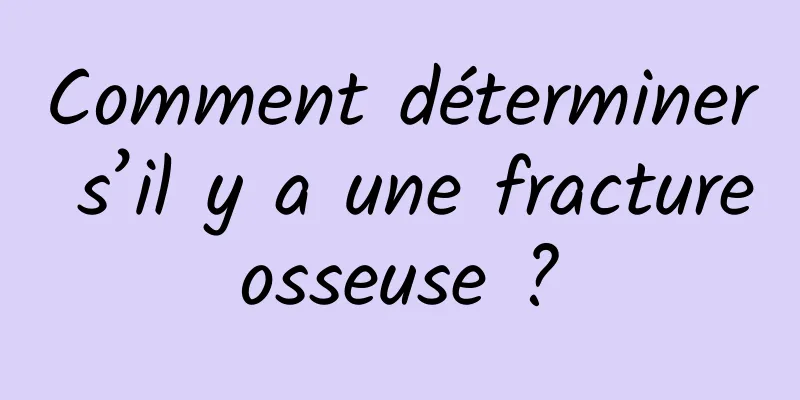 Comment déterminer s’il y a une fracture osseuse ? 