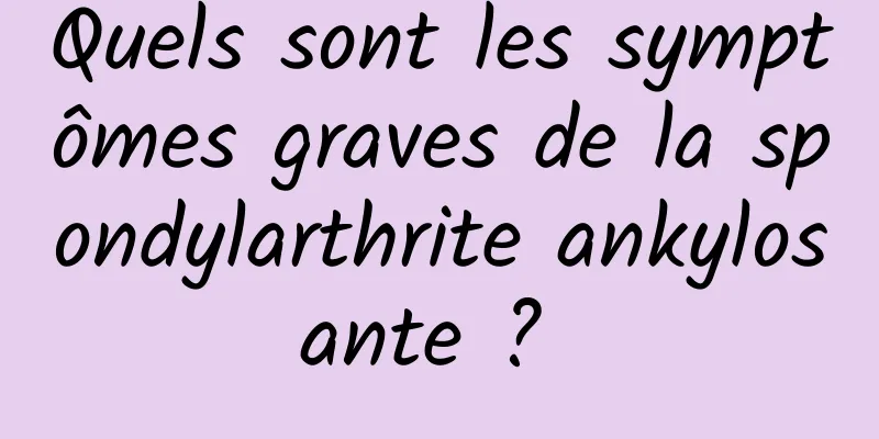 Quels sont les symptômes graves de la spondylarthrite ankylosante ? 