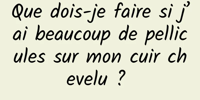 Que dois-je faire si j’ai beaucoup de pellicules sur mon cuir chevelu ? 