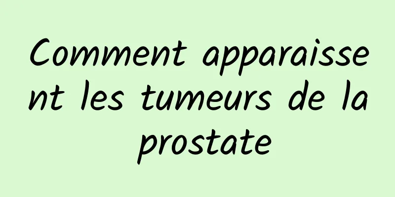 Comment apparaissent les tumeurs de la prostate